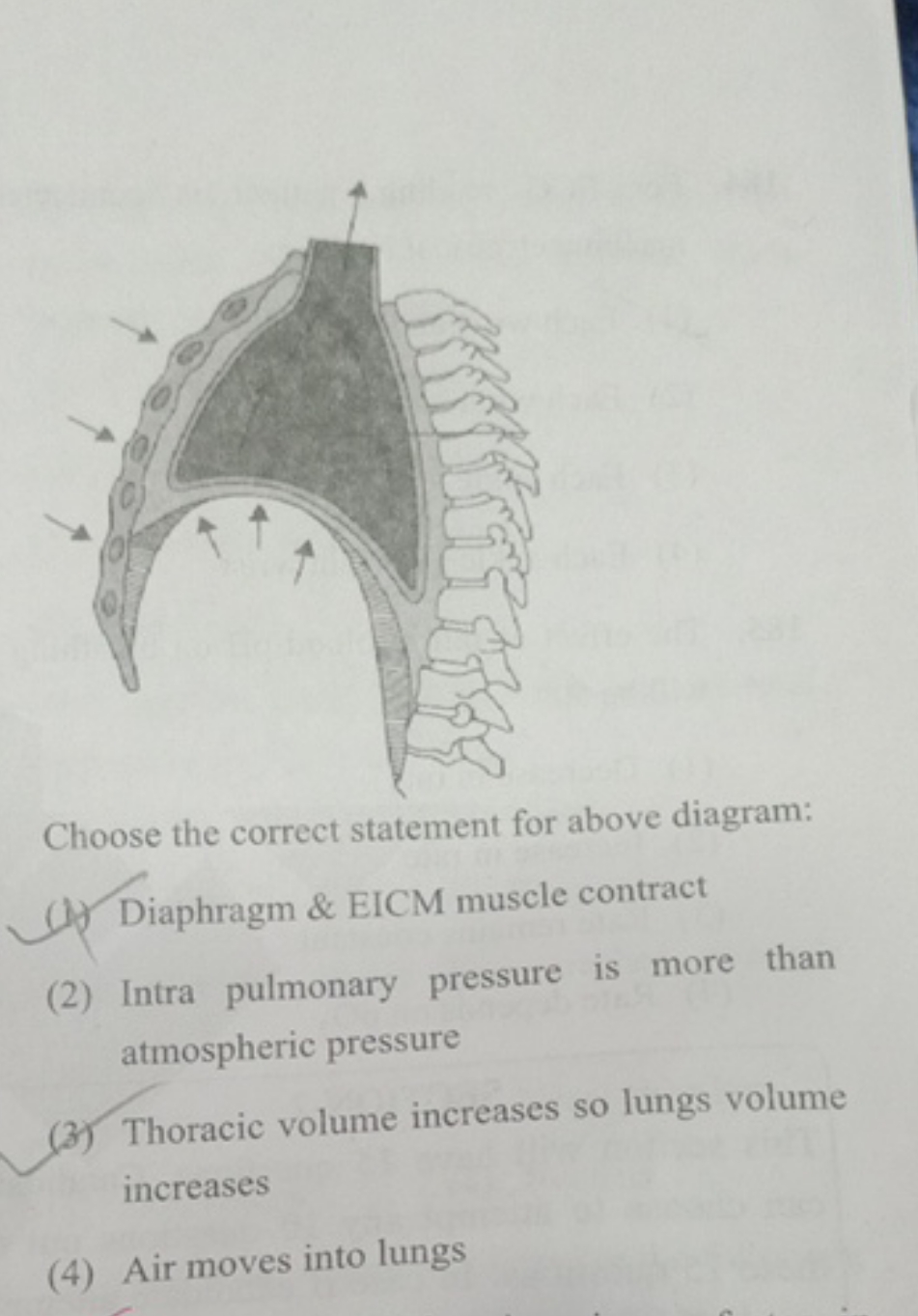 Choose the correct statement for above diagram:
(1) Diaphragm \& EICM 