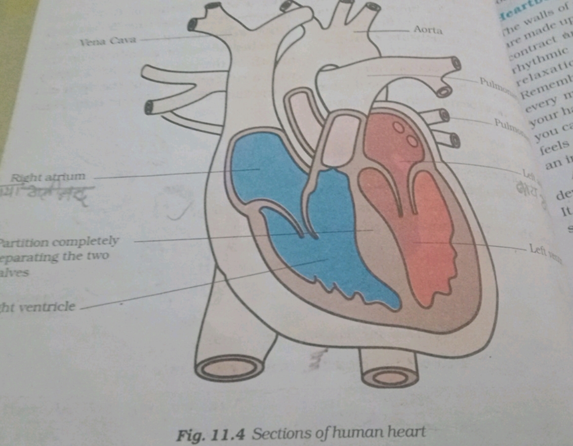 Fig. 11.4 Sections of human heart
