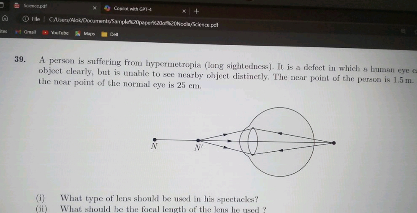 39. A person is suffering from hypermetropia (long sightedness). It is