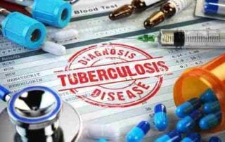 TBC (Tuberkulosis) Gejala, Penyebab dan Cara Pengobatan 03 - Finansialku