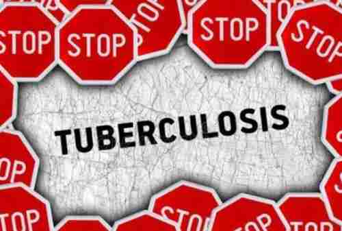 TBC (Tuberkulosis) Gejala, Penyebab dan Cara Pengobatan 02 - Finansialku