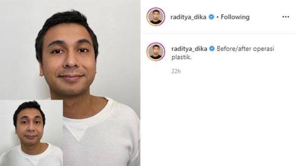 Mau Ikutan Oplas Challenge Begini Cara Menggunakan Faceapp 9969