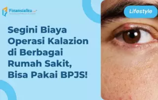 biaya operasi kalazion