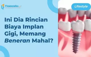 biaya implan gigi