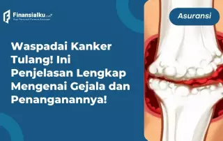 Penting: Kenali Gejala, Penanganan, dan Biaya Pengobatan Kanker Tulang