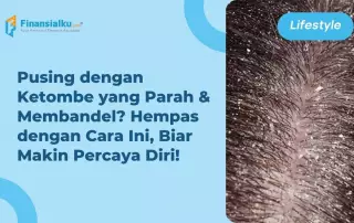 cara menghilangkan ketombe