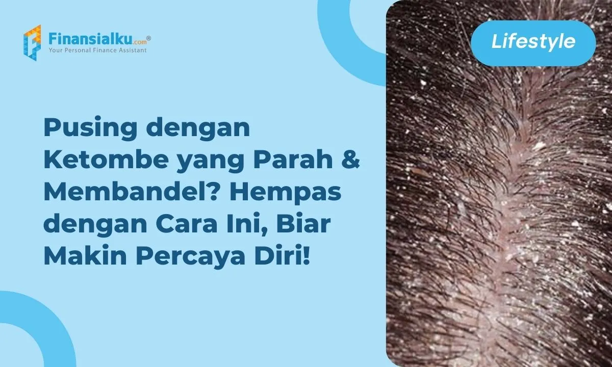 Cara Menghilangkan Ketombe pada Pria: 12 Tips yang Terbukti Ampuh