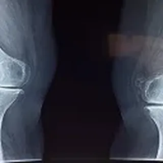 Orthopaedic
