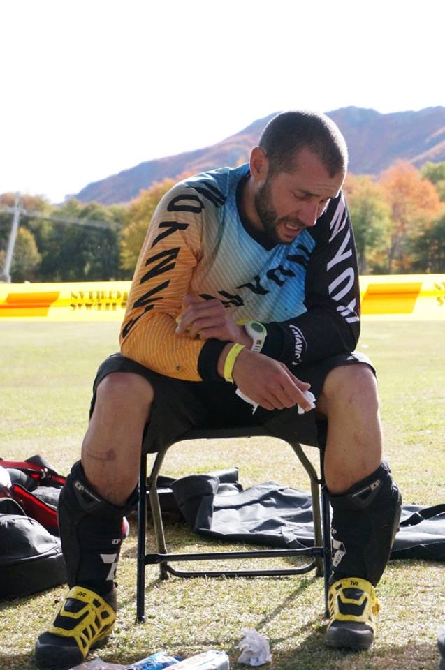 Fabien Barel post-accident. This man is as hard as nails. Photo: Canyon Factory Enduro Team