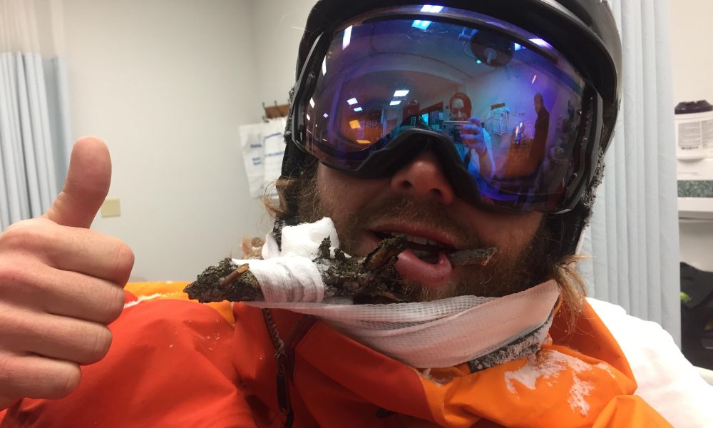 ski instructor stick in face