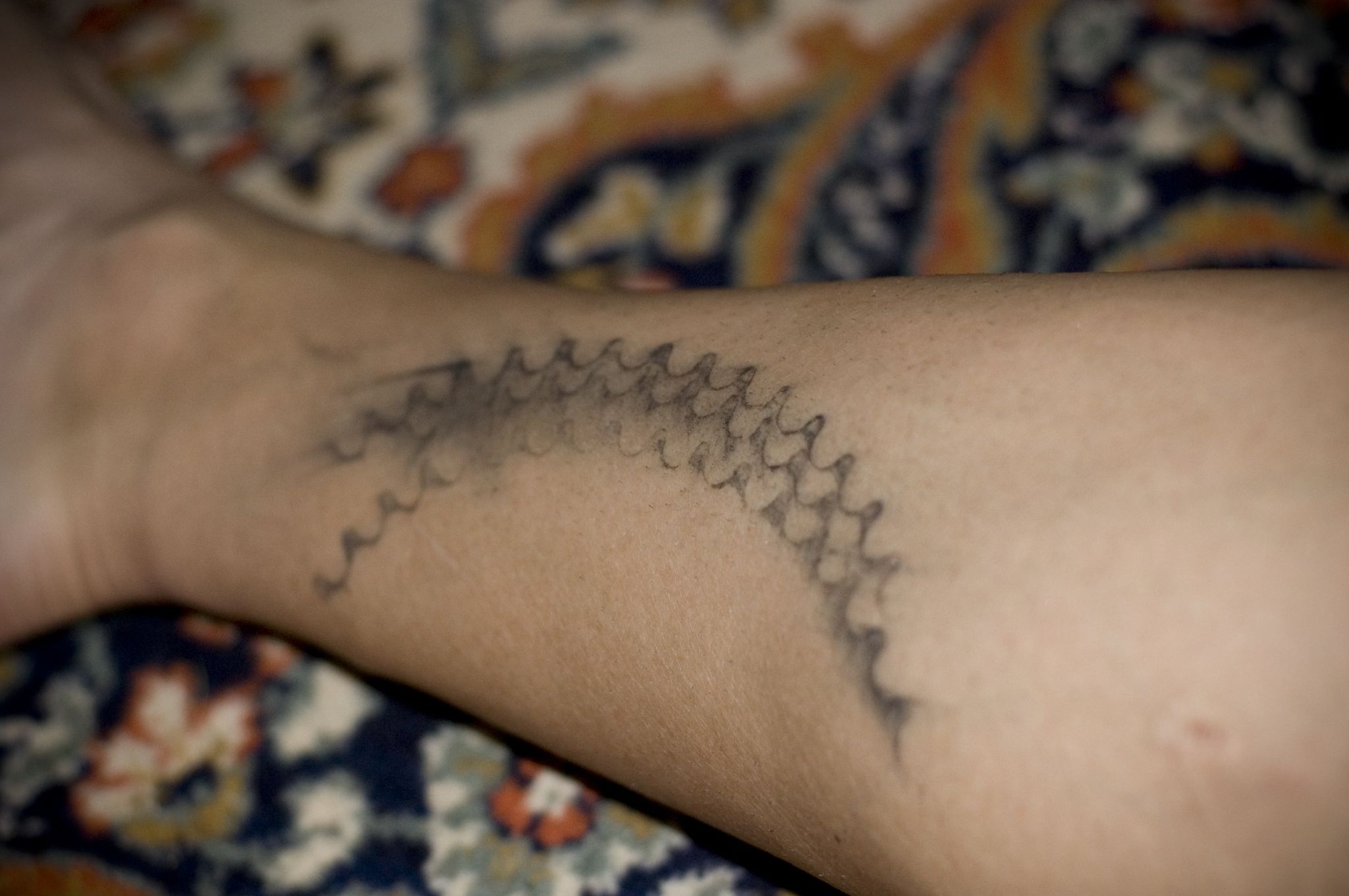 Chainring marks, fourth cat tat, pic: teakwood, via Flickr Creative Commons