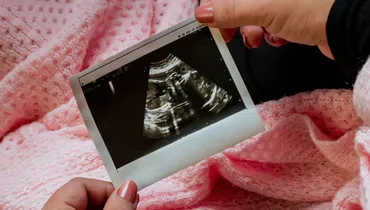 How One Ultrasound Can Change Everything with Dan Steiner