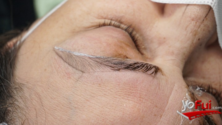 Fotografía en Reconstrucción gratuita de cejas a mujeres con cáncer, Consulta Dra. Carolina Valdés