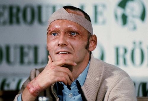 Niki Lauda dopo l'incidente del Nurburgring