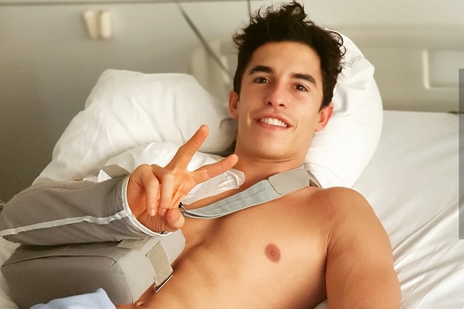 MotoGP | Marc Marquez: “Operazione ok”