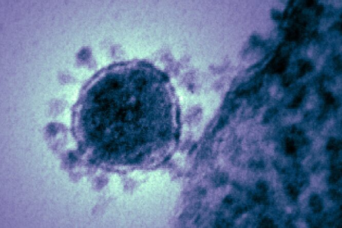 Coronavirus: buone notizie sulle cause dei decessi