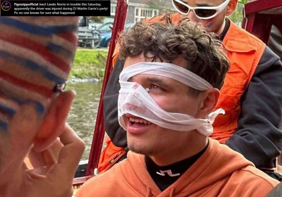 Lando Norris ferito al naso ad Amsterdam alla Festa del Re 2024