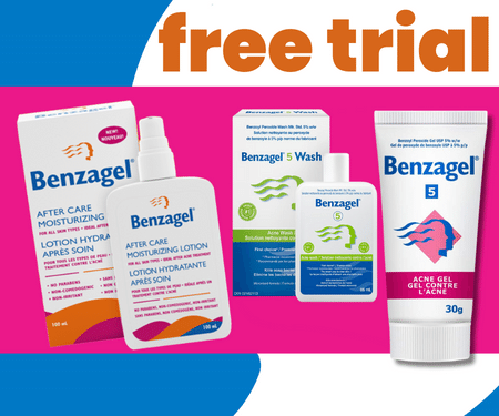 Free Benzagel Acne Treatment Regimen Trial