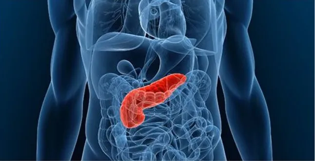 Pancreas karkinos