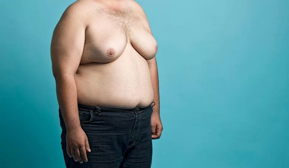 gynaikomastia 1221211111.jpg