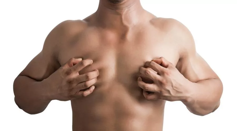 gynaikomastia 22212222 1.jpg