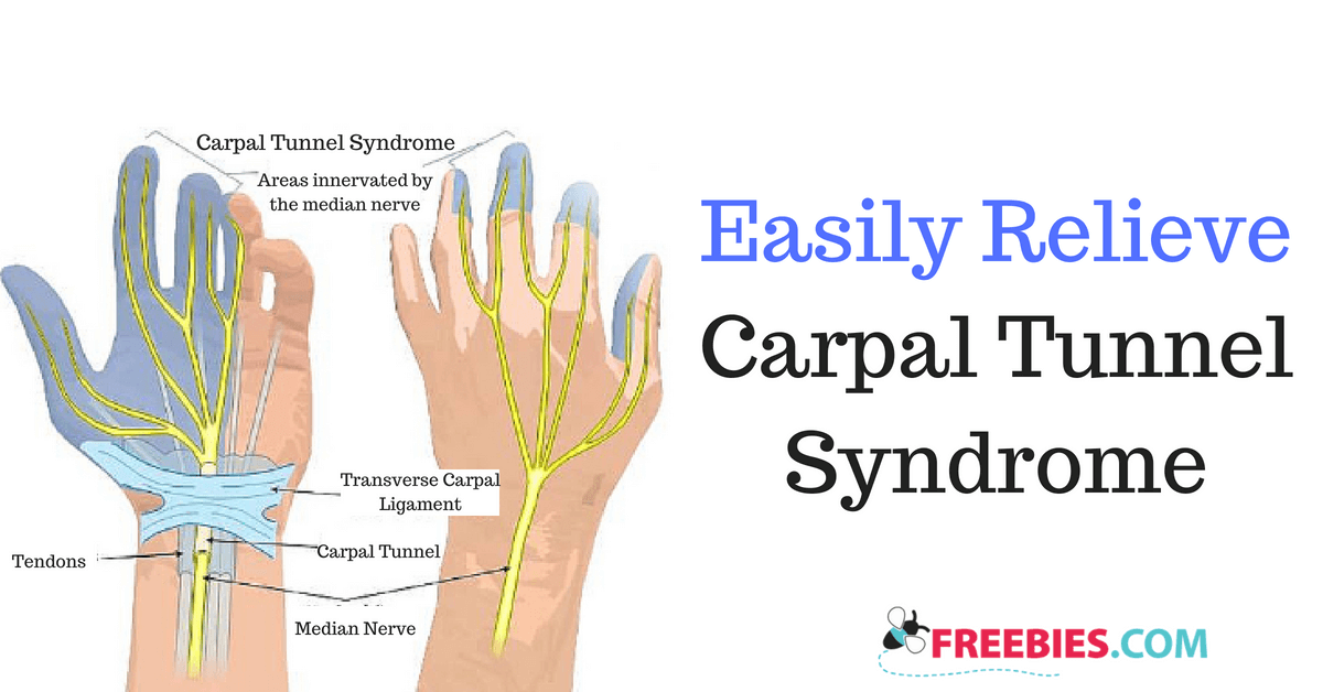 Easily Relieve Carpal Tunnel Syndrome