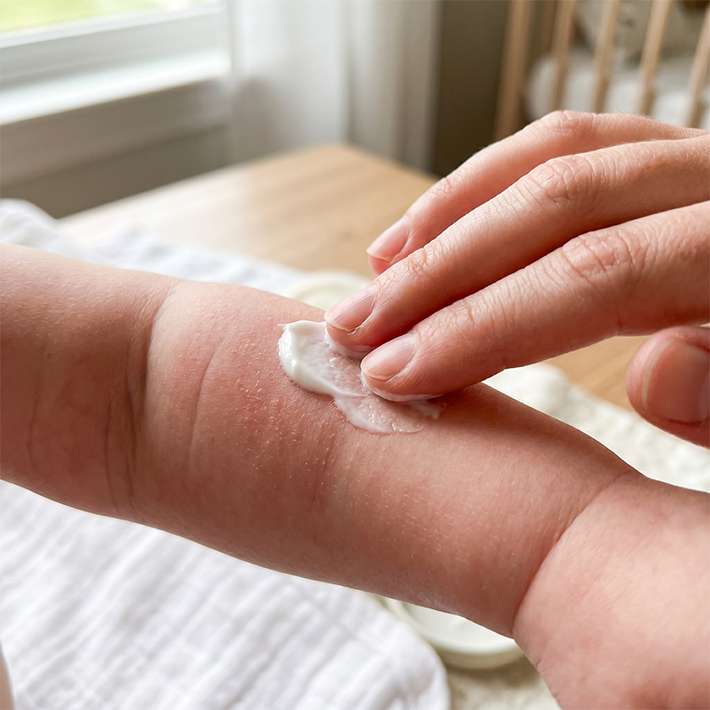 Baby Rash Cream