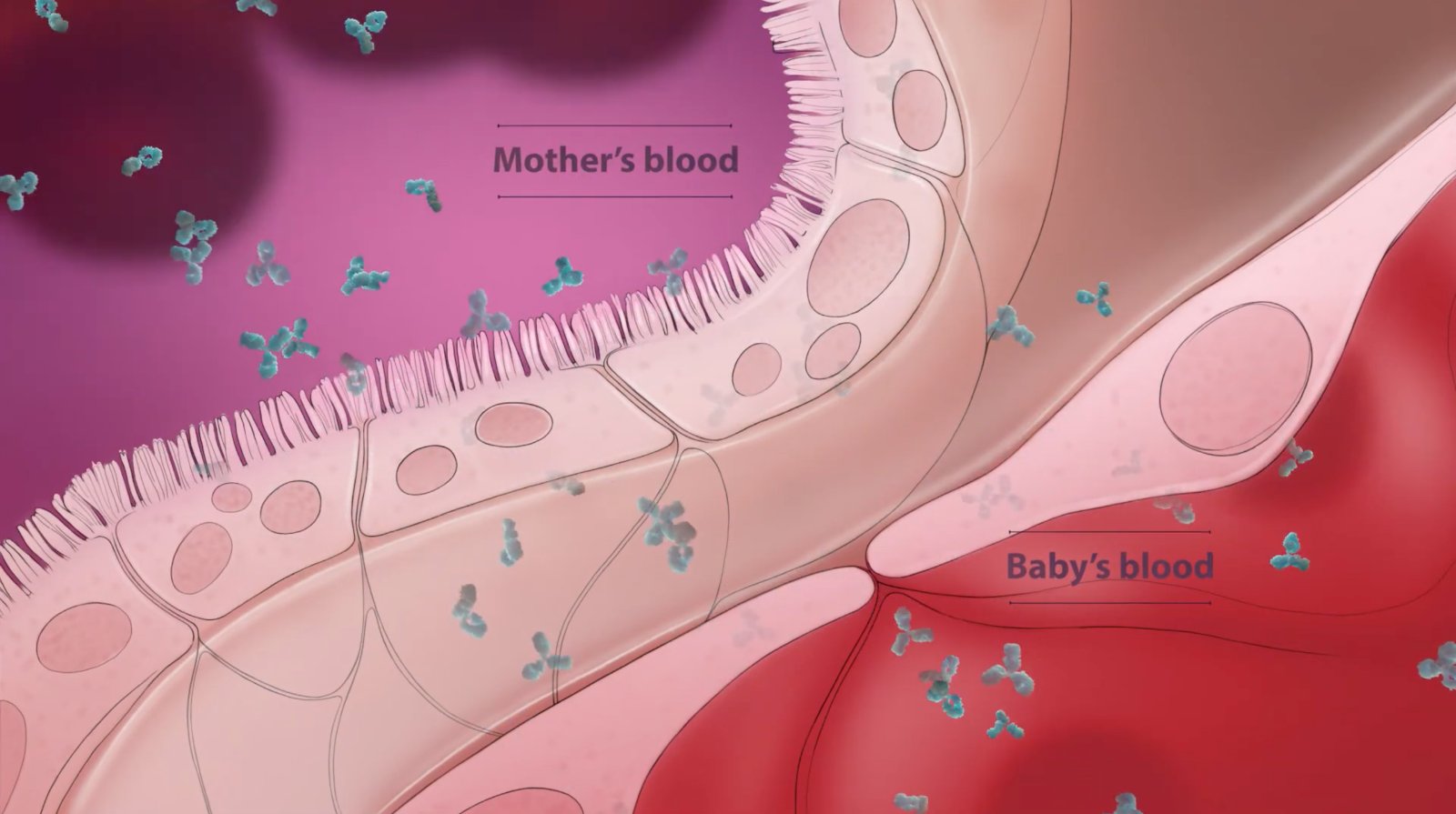 Novavax-疫苗開發-RSV-呼吸道融合病毒-嬰幼兒疾病