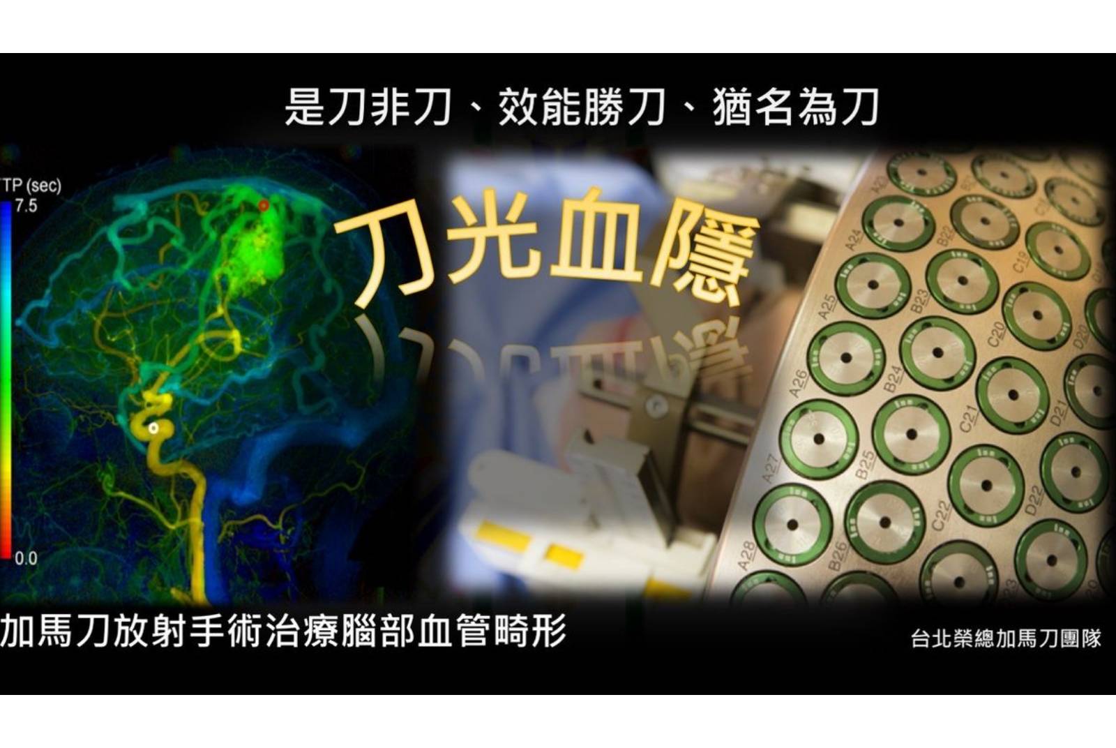 不流血、不用開腦,加馬刀治療中心使腦腫瘤患者再現生機!28年來累積超過八千例,全國居冠