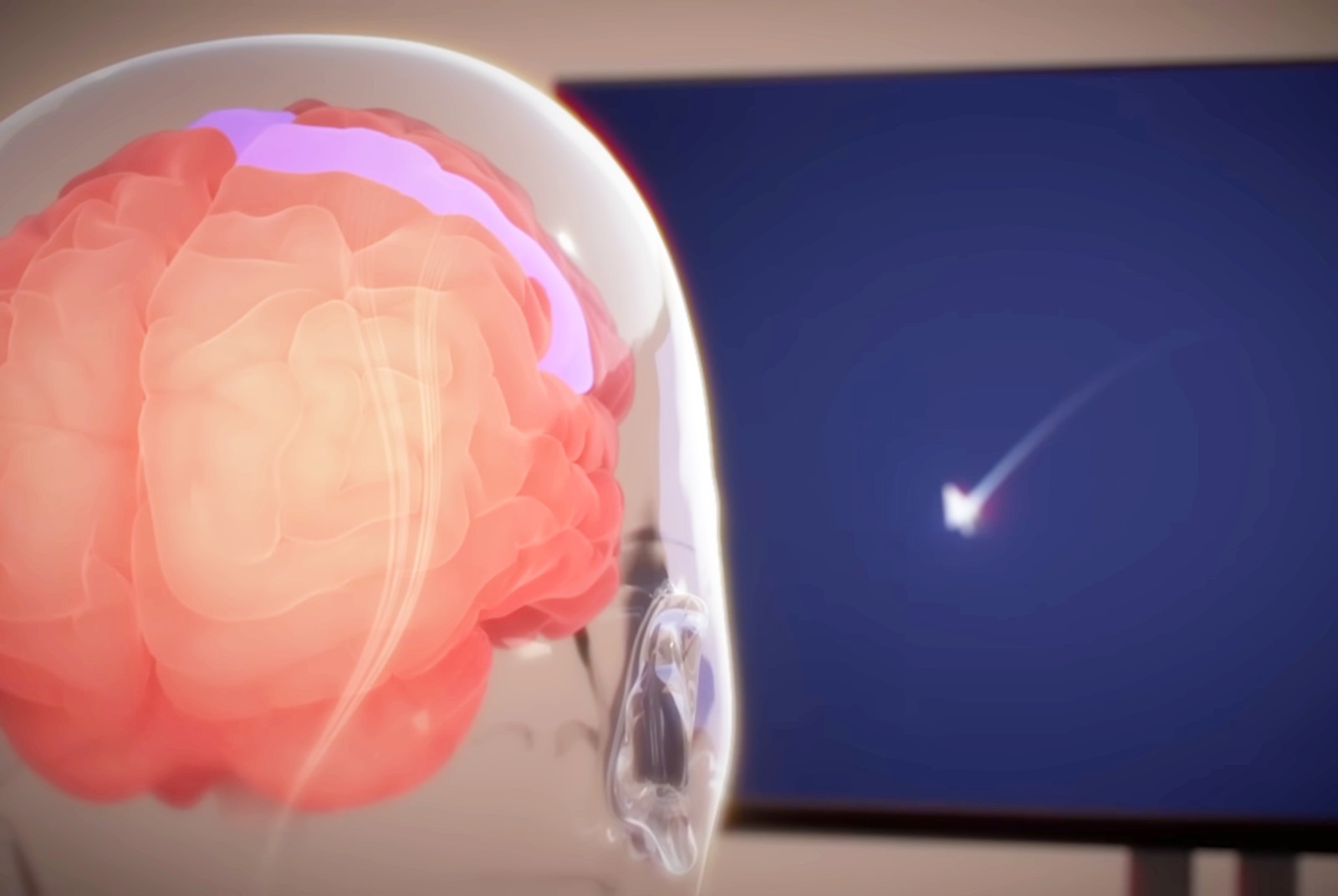 馬斯克-Elon Musk-Neuralink-腦內晶片-人體實驗-人機協作-AI