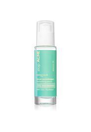 Miraculum stop ACNE siero viso per pelli problematiche, acne 30 ml