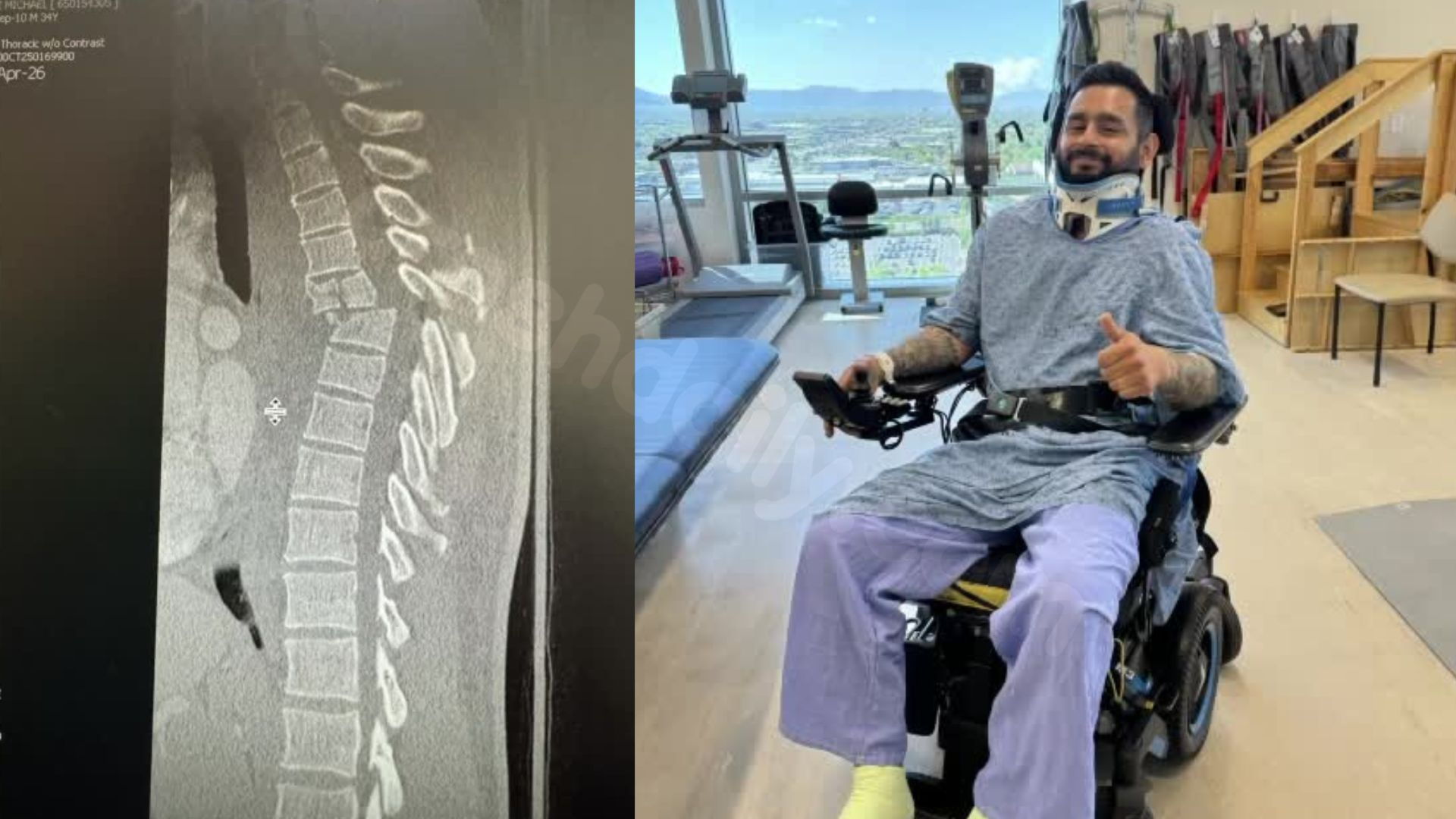 Utah man who suffered massive injuries in motocross accident inspires others with positive attitude