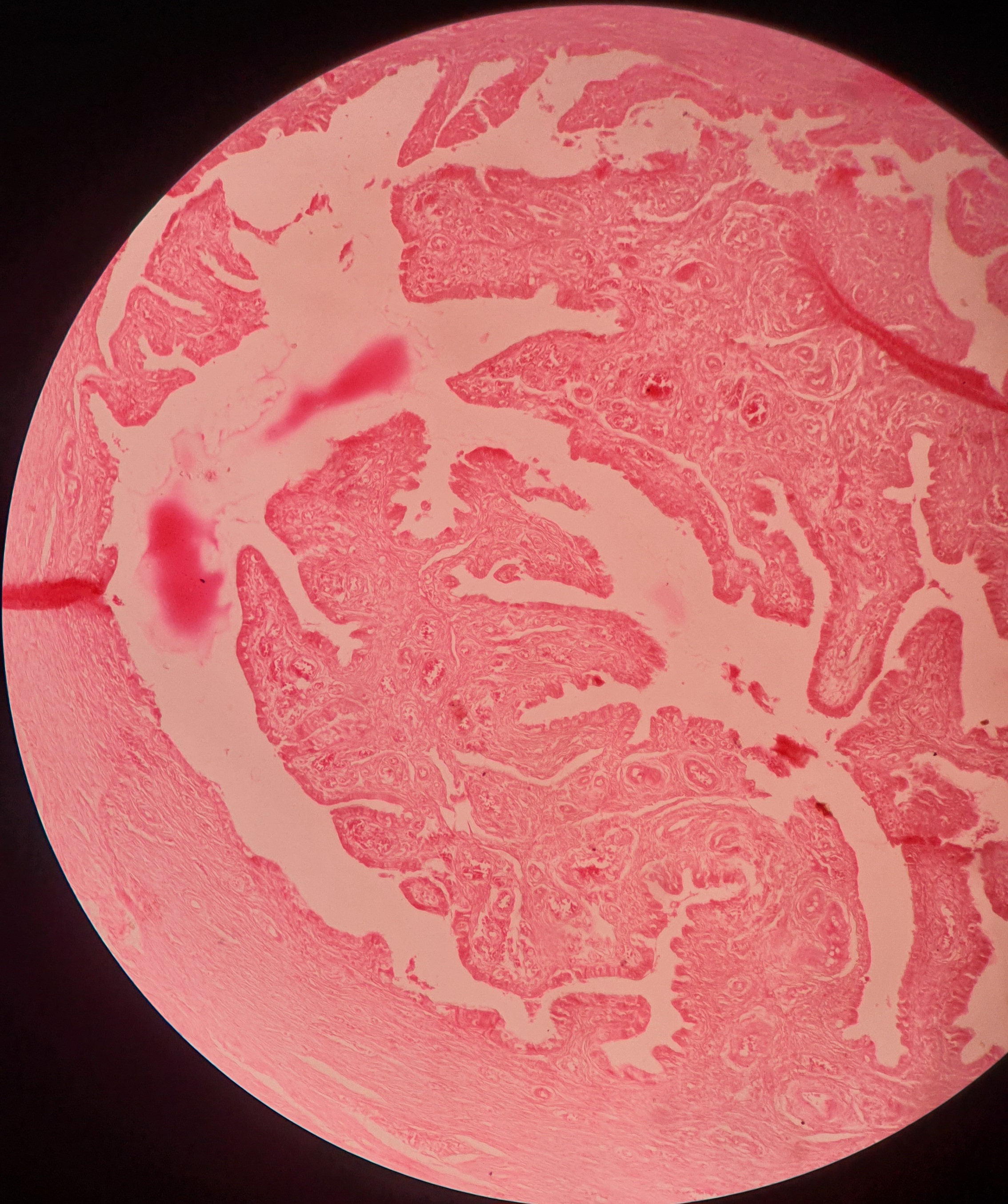 Oviduct 1.jpg