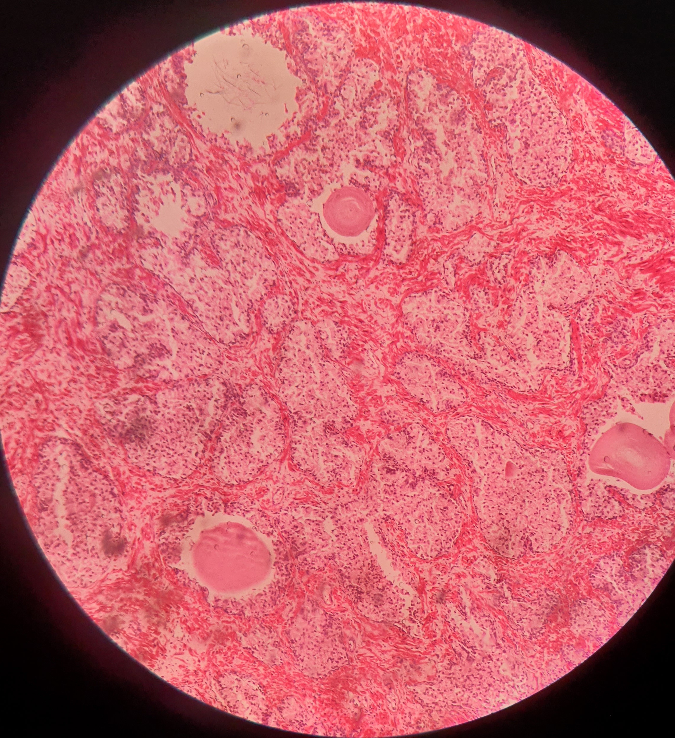 Prostate1.jpg