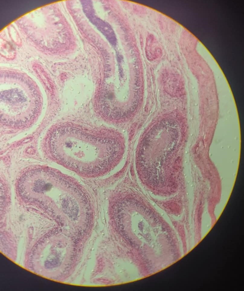 epididymis.jpeg