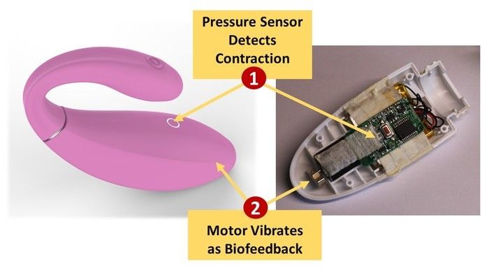 Un kickstarter per un controller pelvico