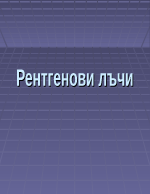 Рентгенови лъчи