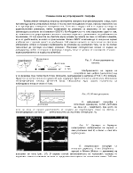 Основна схема на ултразвуковите ехографи