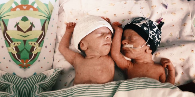 Prematurbarn: Jennie-Lies tvillingar föddes prematurt i vecka 30+3