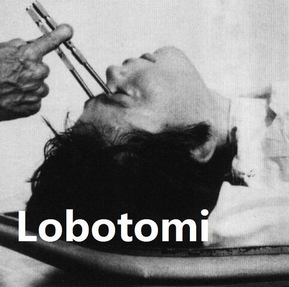 Lobotomy3