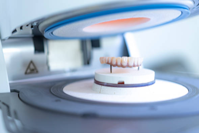 Imagen descriptiva de CAD-CAM en Prótesis Dental