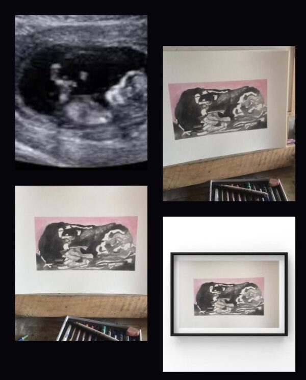 Baby scan portraits - product image 3