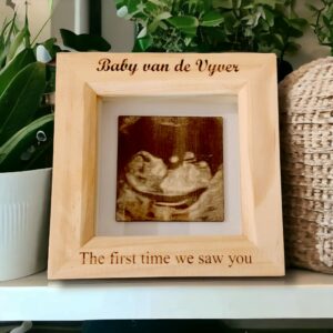 Laser engraved ultrasound in personalised frame