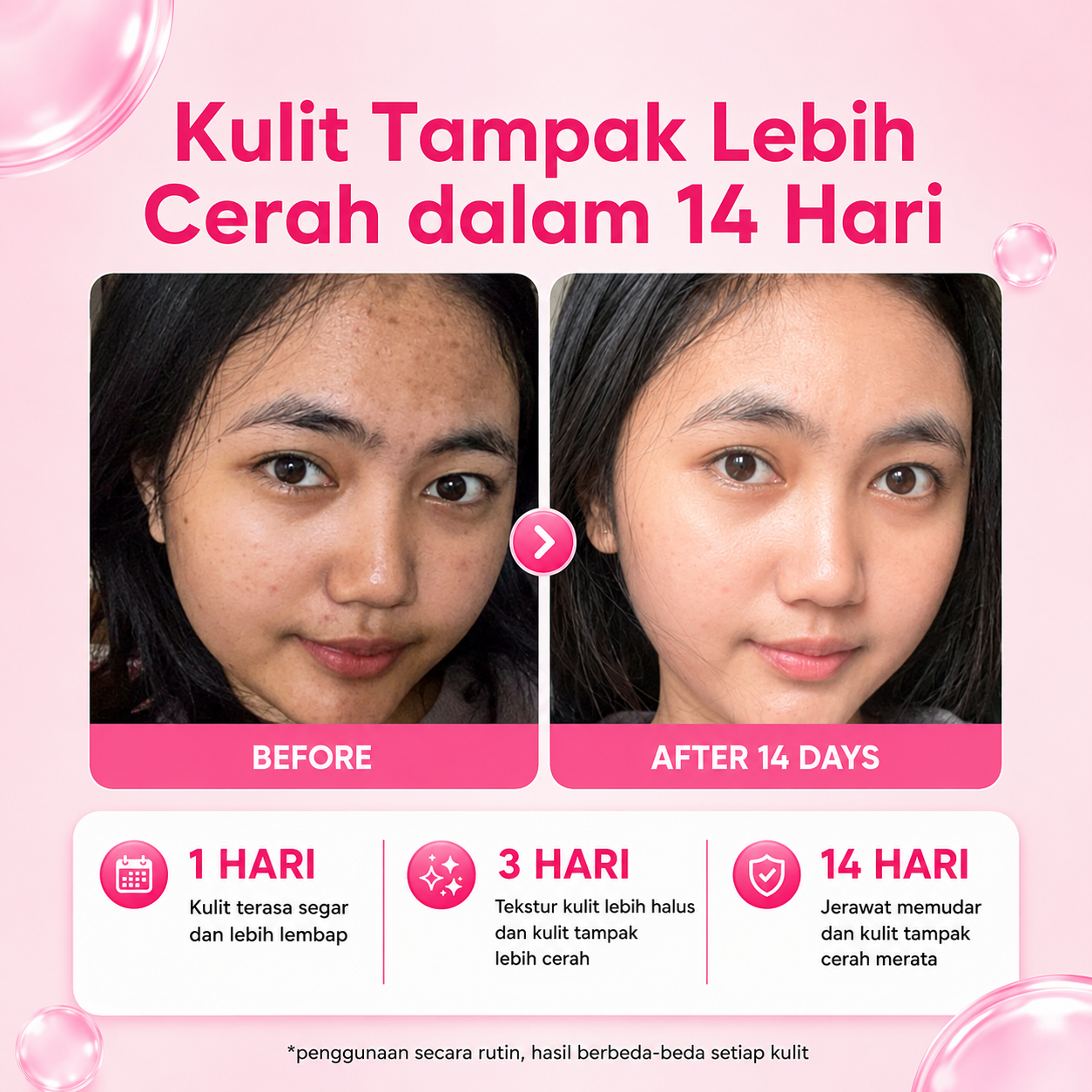 Testimoni Beauty Of Angel 2