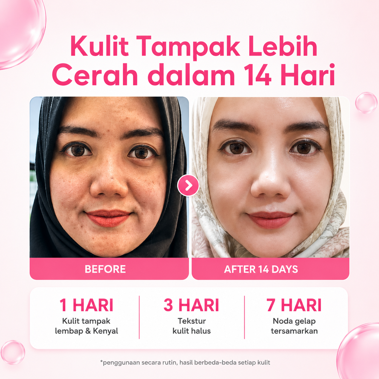 Testimoni Beauty Of Angel 1