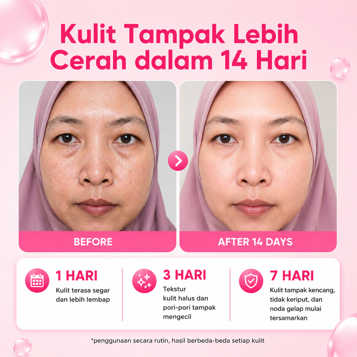 Testimoni Beauty Of Angel 3