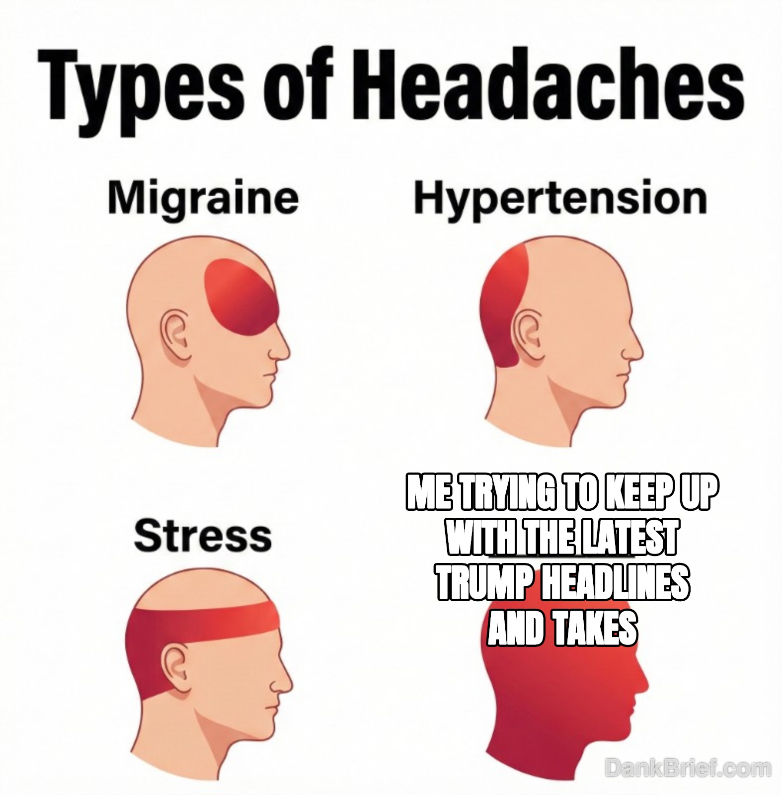 My brain is fried, bro