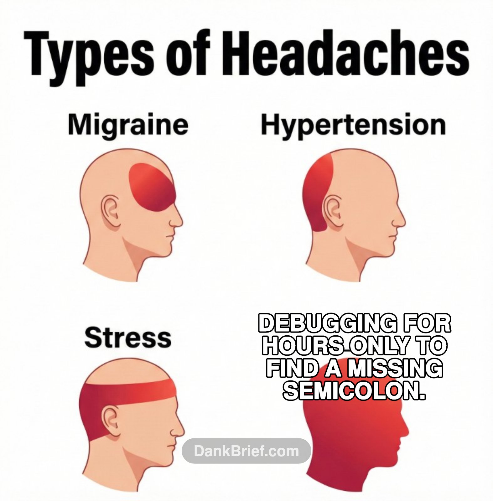 My brain cells are protesting.