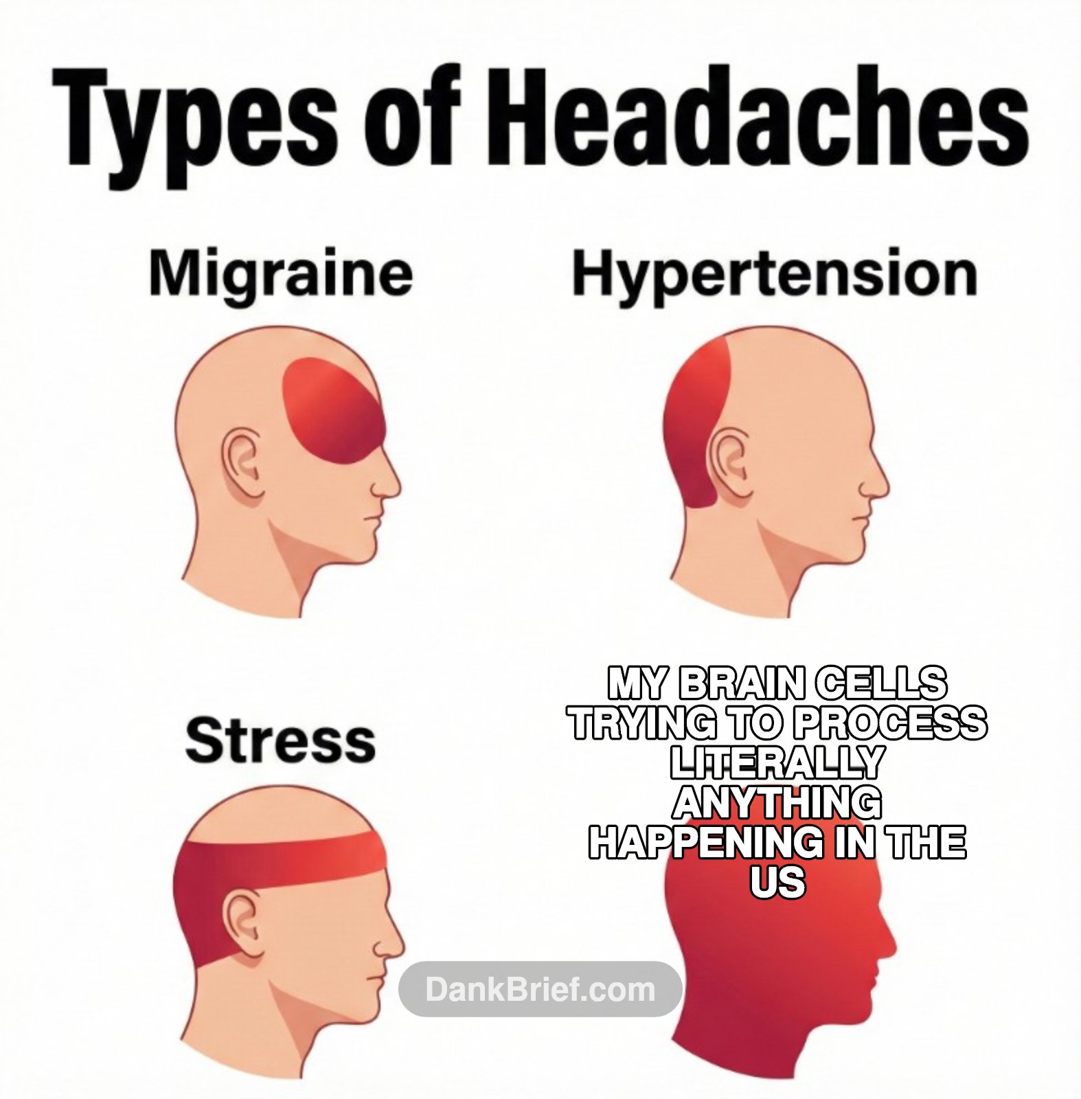It's a lifestyle, bro