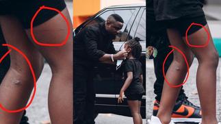 Sarkodie accused of being a strict dad after photos of cane marks on Titi's legs pop up » GhBasecom™